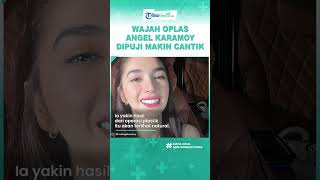Dipuji Makin Cantik bak Masih Gadis, Intip Potret Terbaru Angel Karamoy sesuai Operasi Plastik