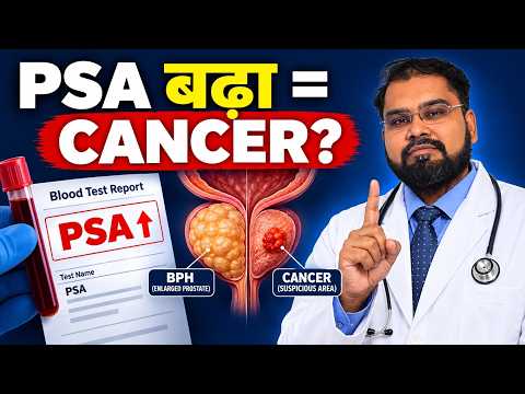 Serum PSA blood test for prostate evaluation explained