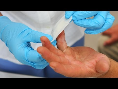 Лечение межпозвонковой грыжи и защемления нерва Как определить дисплазию тазобедренного сустава у собак