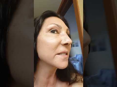 part (5) one hour after  laser treatment BBL & MOXI