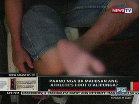 Berdeng amag sa kuko paggamot Kung paano sa pagalingin ang balat sa paligid ng kuko