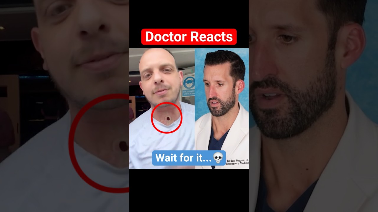 ER Doctor REACTS to Tracheostomy Hole
