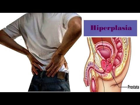 Preparazione per lecografia della prostata negli uomini per via rettale Differisce da massaggio prostatico urologica