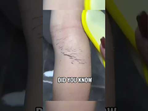 Dermasuri Exfoliating Glove: Ultimate Body Scrubber for Smooth Skin | Remove Dead Skin & Spray Tan