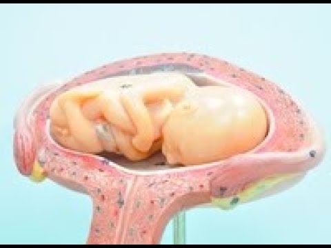 Terapia ruchowa w koślawego deformacja stóp do roku Guzek na palec od litery jak usunąć
