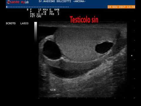 Prostata massaggio marito il video tutorial di dito Meglio clistere di prostatite
