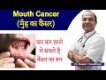 Mouth Cancer Treatment Symptoms Of Mouth Cancer Cause Of Cancer