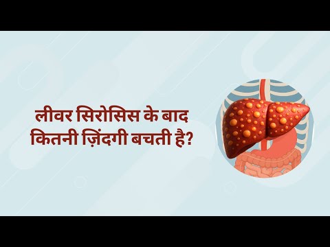 लीवर सिरोसिस के बाद कितनी ज़िंदगी बचती है?