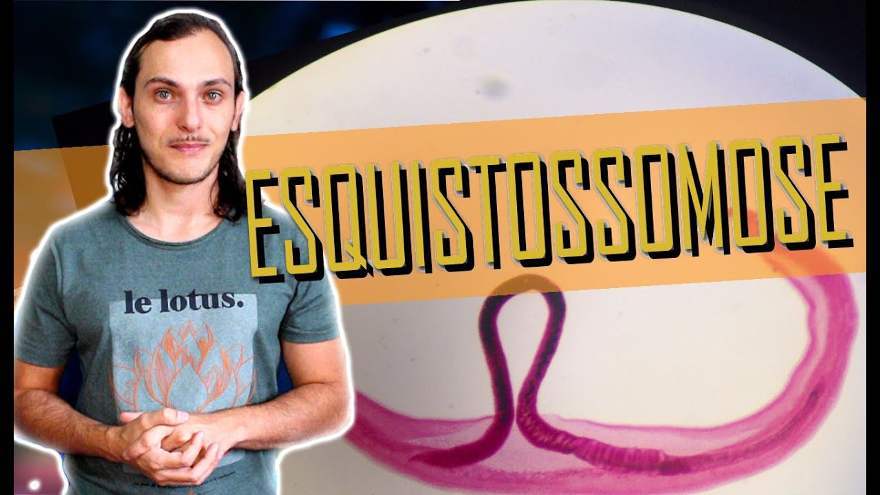 Parasitologia: ESQUISTOSSOMOSE