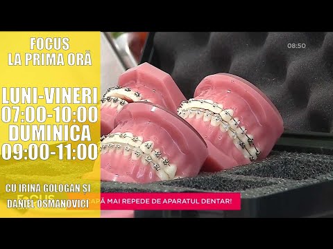 SCAPĂ MAI REPEDE DE APARATUL DENTAR. SĂNĂTATE CU STIL CU LUCIANA INDRE