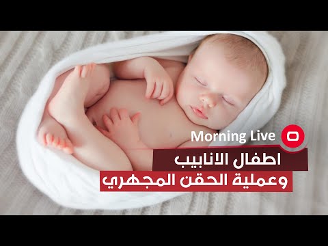 شاهد بالفيديو.. هل هنالك فرق ما بين اطفال الانابيب وعملية الحقن المجهري؟