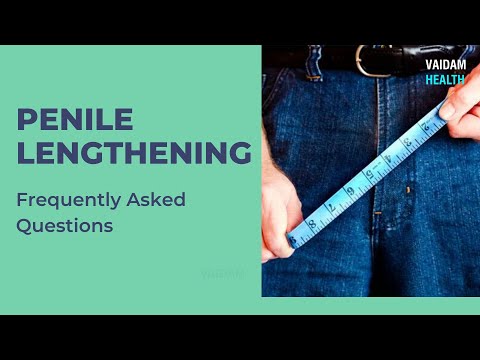 Penile Lengthening - Frequently Asked Questions