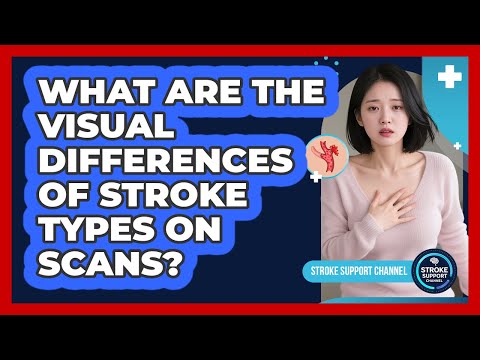 What Are The Visual Differences Of Stroke Types On Scans? - Stroke Support Channel
