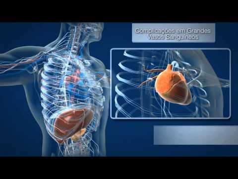 Chirurgia del cancro della prostata e la riabilitazione Vitaprost e la differenza prostatilen