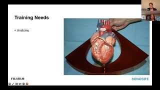 The Importance of Simulation Training for Transesophageal Ultrasound at the Point of Care