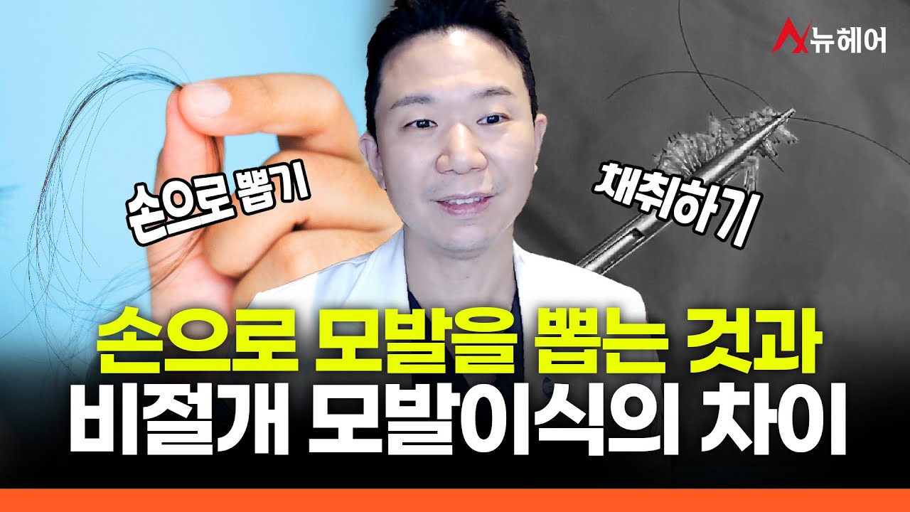 손으로 모발 뽑기와 비절개 모발이식의 차이점ㅣ뉴헤어