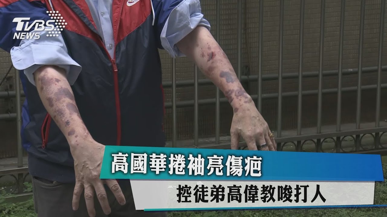 高國華捲袖亮傷疤 控徒弟高偉教唆打人