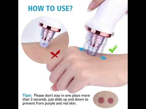 Multi Functional Cleaning Blackheads Remover