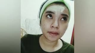 Download lagu Review masker ovale khusus untuk muka berjerawat bruntusan. Hilang! mp3