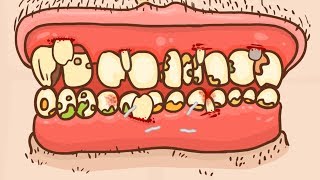 Grossest Game Ever! - Mouth Surgeries and Maggot Removal -  Super Sports Surgery Rugby