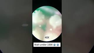 Download lagu Worn toothbrush look cool at 100x magnification! #underthemicroscope #microscope #science#shorts mp3