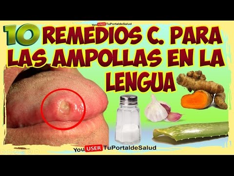 El hongo de la uña el tratamiento a los niños El hongo de las uñas en la piel de los pies que curar