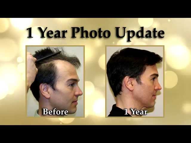 Jeff's Surgery