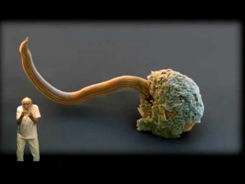 Koprogramma una ricerca su uova di helminths Linsetto diventa un parassita questo