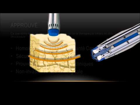comment traiter epine calcaneenne