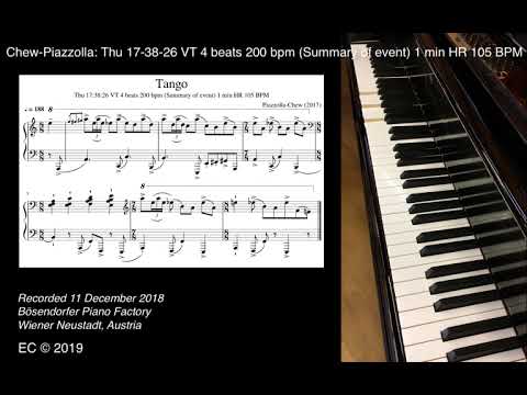 Chew-Piazzolla (3): Thu 17-38-26 VT 4 beats 200 bpm (Summary of event) 1 min HR 105 BPM