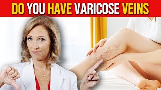 Get Rid of Varicose Veins Fast with These 5 Tips | Dr. Janine