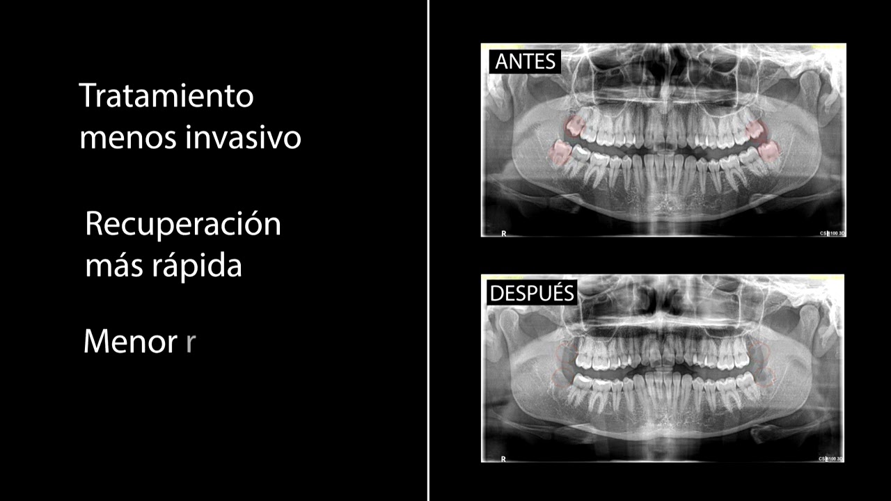 Guillermo Moreno Masiá-99