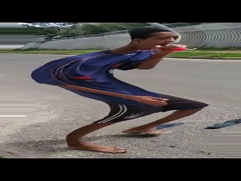 TICOLE É MUITO BOM SÓ QUE BUGADO