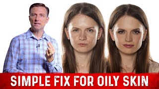 How To Fix Oily Skin With Simple Hack – Dr.Berg