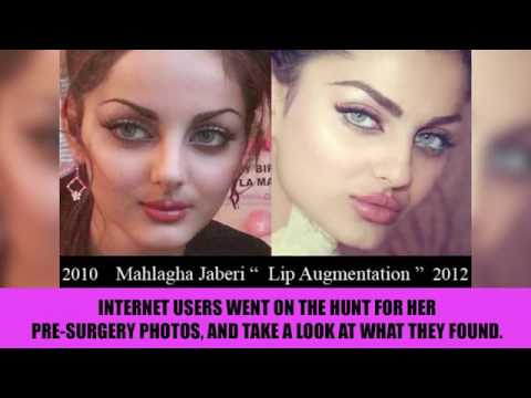 10 Instagram Models BEFORE Plastic Surgery