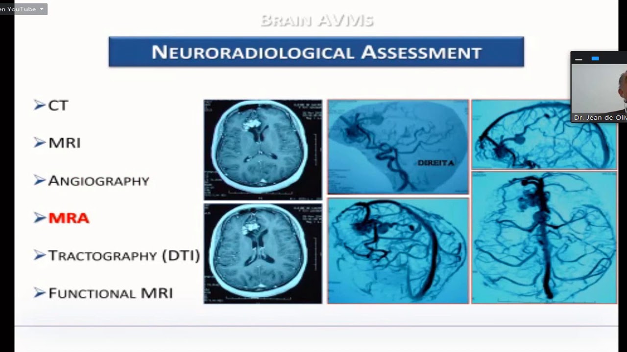 Jean G. De Oliveira-30