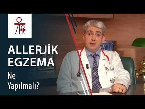 Çocuğumda/bebeğimde alerjik egzema ortaya çıktı. Bununla ilgili ne yapmam gerekir?