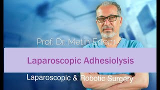 Miniaturka - Laparoscopic Adhesiolysis. Metin Ertem MD.FACS