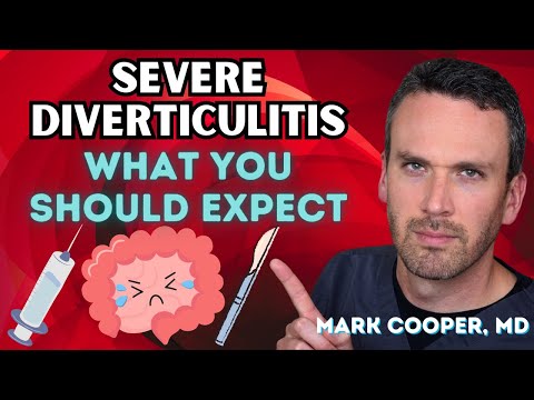 Diverticulitis - Hospitalization and Complications