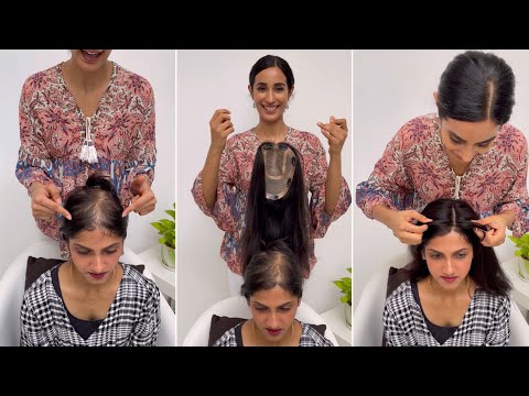 Silk Crown Hair Topper For Hair Thinning | Hair...