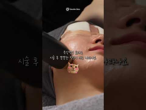 티타늄