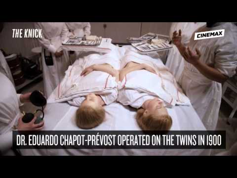 The Knick Season 2 - Factoid Conjoined Twins (Cinemax)