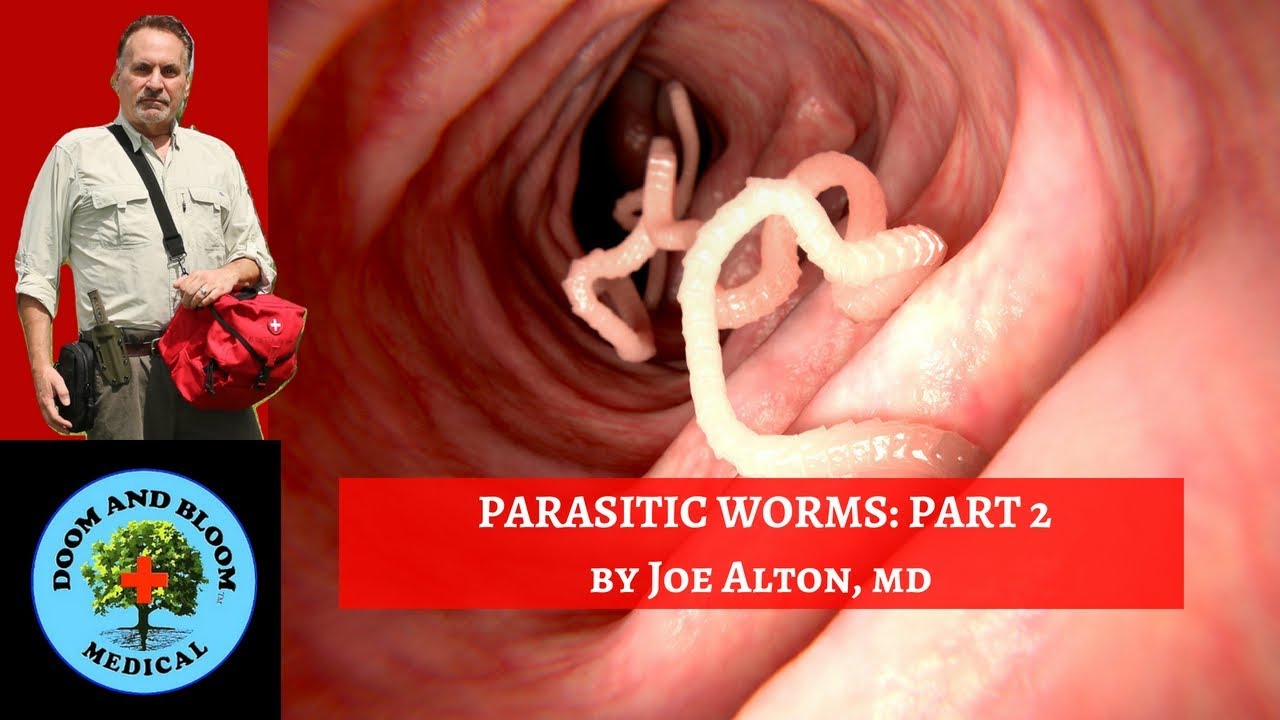 Parasitic Worms Part 2: Diagnosis and Treatments - YouTube
