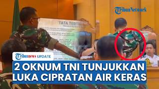 2 Oknum TNI Penyiram Andri Yunus Pamer Luka Bakar Hasil Cipratan Air Keras di Depan Hakim Sidang