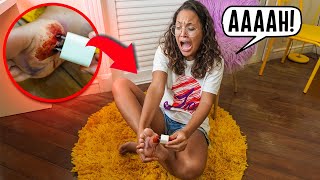 A RAFA SE MACHUCOU FEIO! ALGO BIZARRO ACONTECEU NO PÉ DELA! - DEU RUIM!