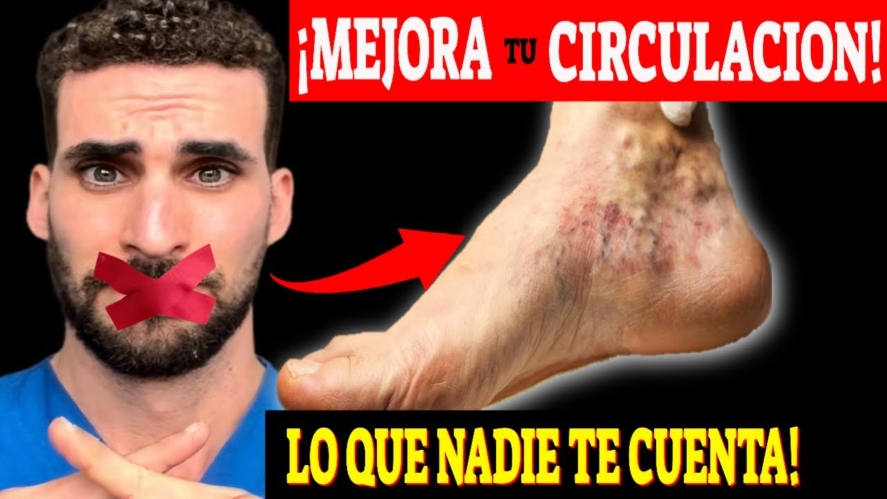 CURA la MALA CIRCULACIÓN ¡SIN REMEDIOS!