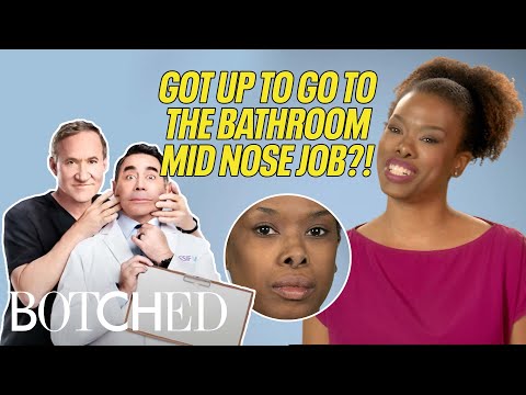 Kelli's Was A Model Until Photographers Told Her To Get a Nose Job?! (Before & After) | Botched | E!