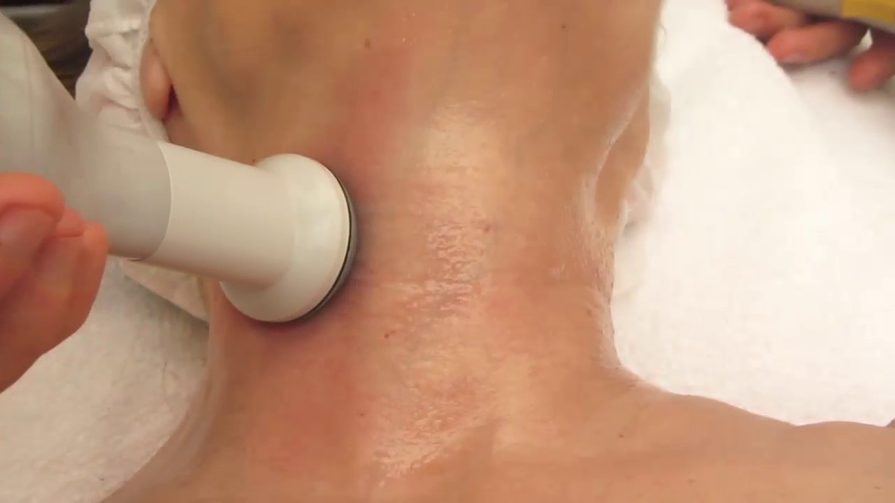 Watch Radiofrecuencia facial: Cuello y papada Now Radiofrecuencia facial: Cuello y papada