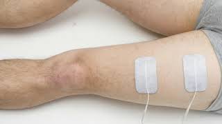 Difference Between Sensory and Motor Nerves