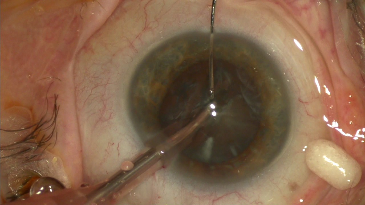 Biagio Giorgio Gagliano-6